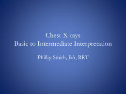 Chest X-Rays – Basic to Intermediate Interpretation – Phillip Smith