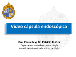 Video cápsula endoscópica - Endoscopia UC
