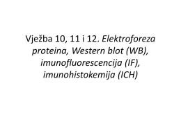 Vje*ba 4. Immunoblot (detekcija)