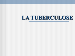 Diagnostic de la Tuberculose pulmonaire