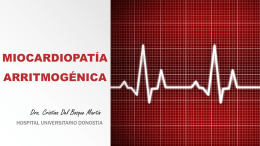 Miocardiopat&iacute;a arritmog&eacute;nica