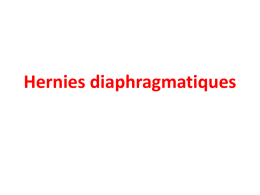 Hernies diaphragmatiques