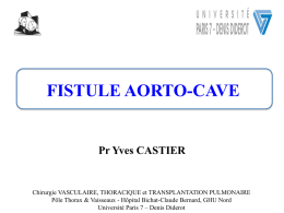 Fistule Aorto-Cave - chirurgie vasculaire thoracique & endocrinienne