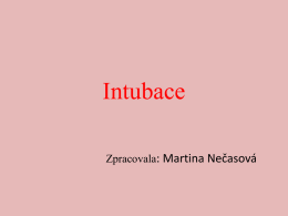 Intubace