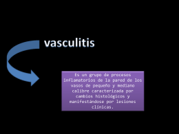 vasculitis - facultaddemedicina