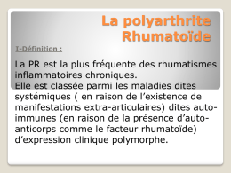 Polyarthrite rhumatoide