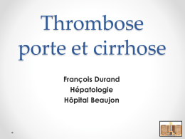 Thrombose porte et cirrhose