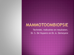 mammotoombiopsie