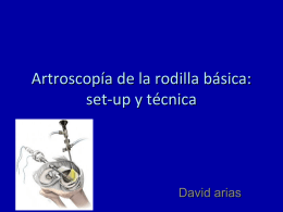 Artroscopía de la rodilla básica