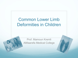 Common Lower Limb Deformities in Children AlMaarefa