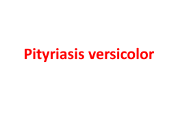 Pityriasis versicolor