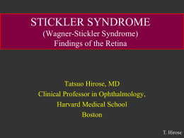 (Wager-Stickler Syndrome) Findings of Retina