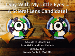 Sclera Contact Lens Candidate