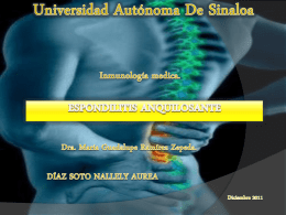 Espondilitis Anquilosante - Universidad Autónoma de Sinaloa