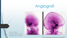 ppt-presentation för Angiografi