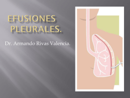 Efusiones Pleurales. - cirugiaOncologia.com