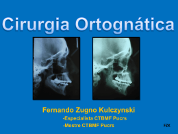 O que é a Cirurgia Ortognática?