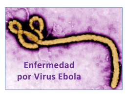 Enfermedad por virus Ebola