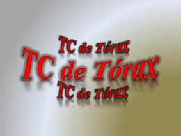 TAC Tórax