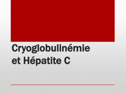 Cryoglobulinémie et VHC2 F