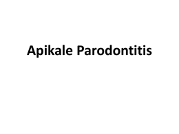 Akute apikale Parodontitis