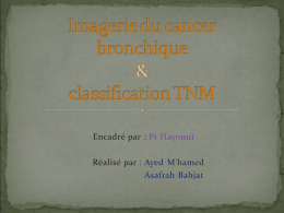 Imagerie du cancer bronchique & classification TNM