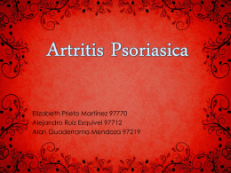 Artritis Psoriasica