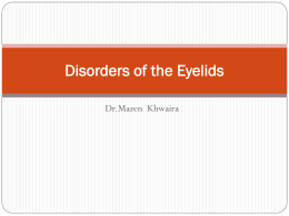 Disorders of the Eyelids