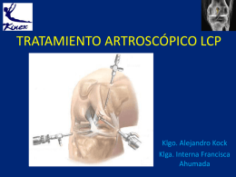 Tratamiento artroscópico de LCP