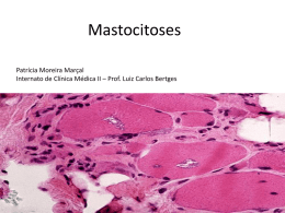 Mastocitoses - Dr. Luiz Carlos Bertges
