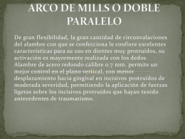 ARCO DE MILLS O DOBLE PARALELO