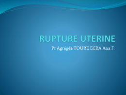 RUPTURE UTERINE - Gyneco-Ci