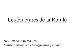 Fractures de la Rotule