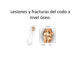 Lesiones y fracturas del codo a nivel óseo