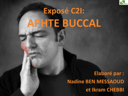 Aphte buccal