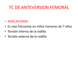 TC DE ANTEVERSION FEMORAL