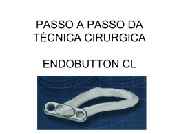 PASSO A PASSO DA TÉCNICA CIRURGICA ENDOBUTTON CL