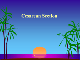 C.Section