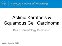 Actinic keratosis and squamous cell carcinoma