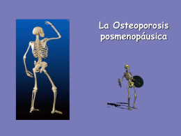 Qué es la Osteoporosis
