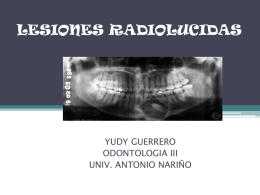 Lesiones Radiolucidas