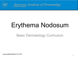 Erythema nodosum - American Academy of Dermatology