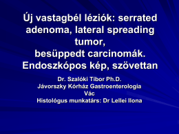 Új vastagbél léziók: serrated adenoma, lateral spreading tumor