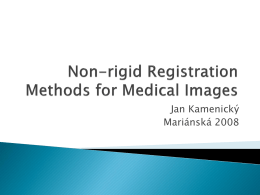 Non-rigid Registration Methods for Medical Images