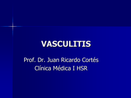 Vasculitis 4 - Unidad Hospitalaria San Roque