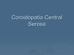 Coroidopatia Serosa Central - Oftalmologia Dr. Rafael Caiado
