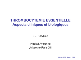 Thrombocytémie Essentielle