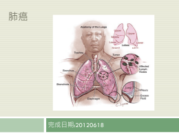 Lung cancer 肺癌overview