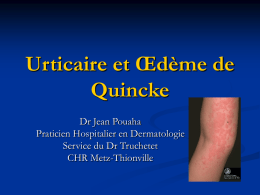 Urticaire et Œdème de Quincke