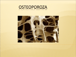 Osteoporoza - UBM :: Departamentul de Chimie